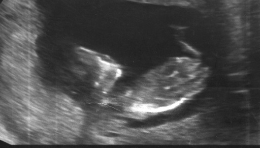 Bébé Emma Trudel